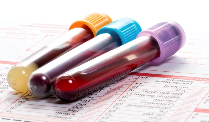 Elevación de enzimas hepáticas - interpretación de las pruebas